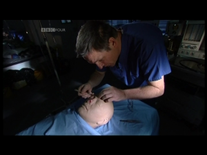 Michael Mosley performing a facial surgery technique on a Mannequin/dummy 